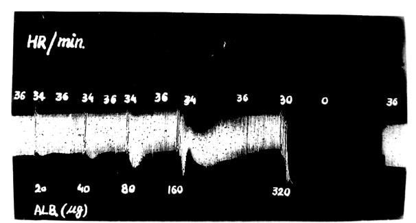 Effect of Drugs on Isolated Frog Heart: Understanding Cardiac Pharmacology